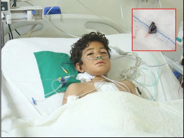 این آئی سی وی ڈی کراچی نے دل میں پیوست گولی نکال کر 12 سالہ بچے کی جان بچالی